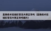 直肠癌术后插肛管流大便正常吗（直肠癌术后插肛管流大便正常吗图片）