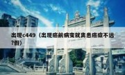 出现c449（出现癌前病变就离患癌症不远?假）