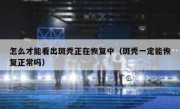 怎么才能看出斑秃正在恢复中（斑秃一定能恢复正常吗）